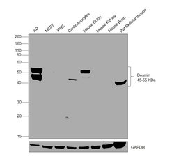 Invitrogen Desmin Recombinant Rabbit Monoclonal Antibody (6O9O4) 100 &mu;L;