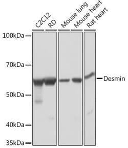 Invitrogen Desmin Recombinant Rabbit Monoclonal Antibody (6O9O4) 100 &mu;L;
