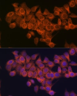 Invitrogen NDUFAF1 Recombinant Rabbit Monoclonal Antibody (4K8Y8) 100 &mu;L;