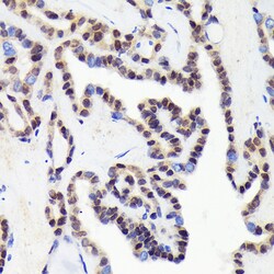 CDCA5 Recombinant Rabbit Monoclonal Antibody (1Y1C9):Antibodies, Recombinant