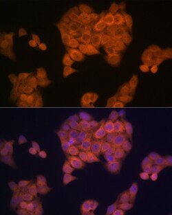 PMP70 Recombinant Rabbit Monoclonal Antibody (3V4K3):Antibodies, Recombinant