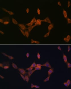 PMP70 Recombinant Rabbit Monoclonal Antibody (3V4K3):Antibodies, Recombinant