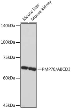 PMP70 Recombinant Rabbit Monoclonal Antibody (3V4K3):Antibodies, Recombinant