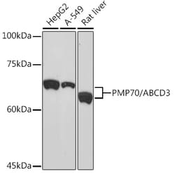 PMP70 Recombinant Rabbit Monoclonal Antibody (3V4K3):Antibodies, Recombinant