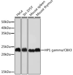 Invitrogen HP1 gamma Recombinant Rabbit Monoclonal Antibody (7B7Q2) 100 &mu;L | Buy Online | Invitrogen&trade; | Fisher Scientific