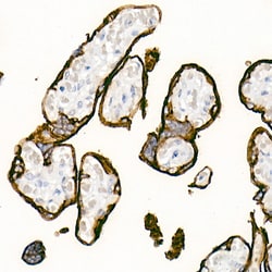 Placental Alkaline Phosphatase Recombinant Rabbit Monoclonal Antibody (10Q2X7):Antibodies,