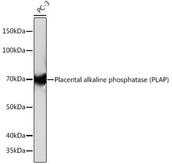 Placental Alkaline Phosphatase Recombinant Rabbit Monoclonal Antibody (10Q2X7):Antibodies,