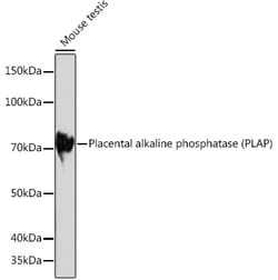 Placental Alkaline Phosphatase Recombinant Rabbit Monoclonal Antibody (10Q2X7):Antibodies,