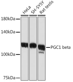 Invitrogen PPARGC1B Recombinant Rabbit Monoclonal Antibody (3K4V1) 100