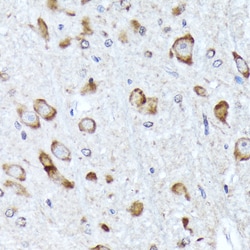 BNIP1 Recombinant Rabbit Monoclonal Antibody (10K6T9):Antibodies, Recombinant