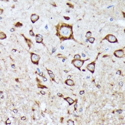 BNIP1 Recombinant Rabbit Monoclonal Antibody (10K6T9):Antibodies, Recombinant