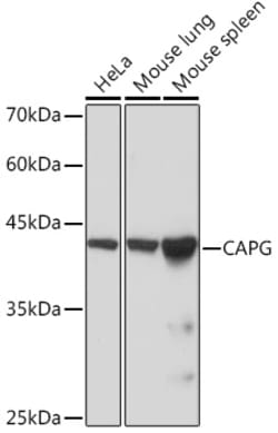 CAPG Recombinant Rabbit Monoclonal Antibody (5V9G1):Antibodies, Recombinant