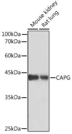 CAPG Recombinant Rabbit Monoclonal Antibody (5V9G1):Antibodies, Recombinant