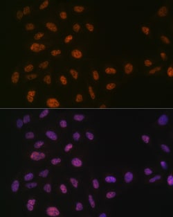 Invitrogen PRP8 Recombinant Rabbit Monoclonal Antibody (4I1Q8) 100 &mu;L;