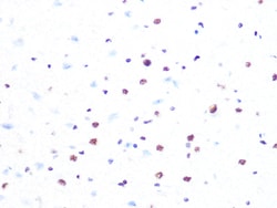 Invitrogen PRP8 Recombinant Rabbit Monoclonal Antibody (4I1Q8) 100 &mu;L;
