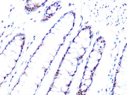 Invitrogen PRP8 Recombinant Rabbit Monoclonal Antibody (4I1Q8) 100 &mu;L;