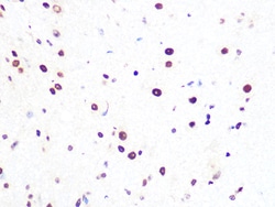 Invitrogen PRP8 Recombinant Rabbit Monoclonal Antibody (4I1Q8) 100 &mu;L;