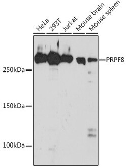 Invitrogen PRP8 Recombinant Rabbit Monoclonal Antibody (4I1Q8) 100 &mu;L;