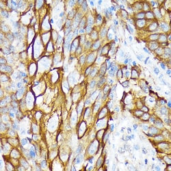 Invitrogen Cytokeratin 6 Recombinant Rabbit Monoclonal Antibody (1T4Z8)