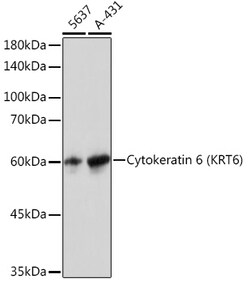Invitrogen Cytokeratin 6 Recombinant Rabbit Monoclonal Antibody (1T4Z8)