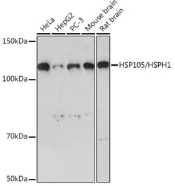 Invitrogen HSP105 Recombinant Rabbit Monoclonal Antibody (9Y7M10) 100 &mu;L;