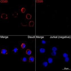 Invitrogen CD20 Recombinant Rabbit Monoclonal Antibody (6L3K5) 100 &mu;L | Buy Online | Invitrogen&trade; | Fisher Scientific