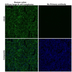 Invitrogen CD20 Recombinant Rabbit Monoclonal Antibody (6L3K5) 100 &mu;L | Buy Online | Invitrogen&trade; | Fisher Scientific