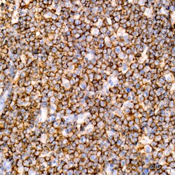 Invitrogen CD20 Recombinant Rabbit Monoclonal Antibody (6L3K5) 100 &mu;L | Buy Online | Invitrogen&trade; | Fisher Scientific