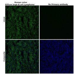 Invitrogen CD20 Recombinant Rabbit Monoclonal Antibody (6L3K5) 100 &mu;L | Buy Online | Invitrogen&trade; | Fisher Scientific