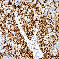 Invitrogen CD20 Recombinant Rabbit Monoclonal Antibody (6L3K5) 100 &mu;L | Buy Online | Invitrogen&trade; | Fisher Scientific