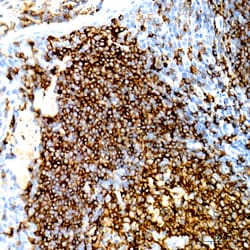 Invitrogen CD20 Recombinant Rabbit Monoclonal Antibody (6L3K5) 100 &mu;L | Buy Online | Invitrogen&trade; | Fisher Scientific