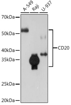 Invitrogen CD20 Recombinant Rabbit Monoclonal Antibody (6L3K5) 100 &mu;L | Buy Online | Invitrogen&trade; | Fisher Scientific