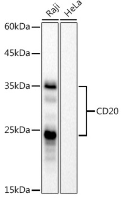 Invitrogen CD20 Recombinant Rabbit Monoclonal Antibody (6L3K5) 100 &mu;L | Buy Online | Invitrogen&trade; | Fisher Scientific