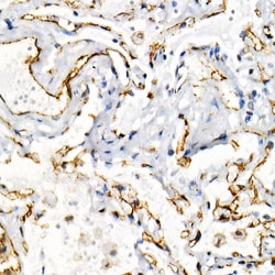 Invitrogen CD31 (PECAM-1) Recombinant Rabbit Monoclonal Antibody (2V8C4)