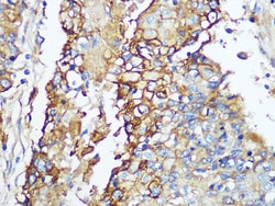 Invitrogen Carbonic Anhydrase IX Recombinant Rabbit Monoclonal Antibody