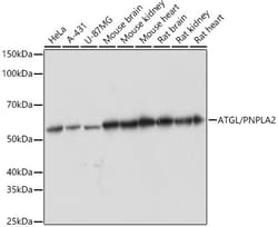 Invitrogen ATGL Recombinant Rabbit Monoclonal Antibody (10Y4M10) 100 &mu;L;