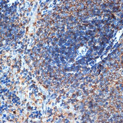 Invitrogen ELMO1 Recombinant Rabbit Monoclonal Antibody (9X6Y6) 100 &mu;L;