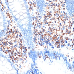 Invitrogen ELMO1 Recombinant Rabbit Monoclonal Antibody (9X6Y6) 100 &mu;L;