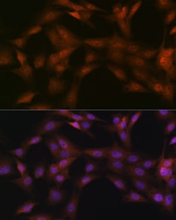 Invitrogen p23 Recombinant Rabbit Monoclonal Antibody (10M9W8) 100 &mu;L;