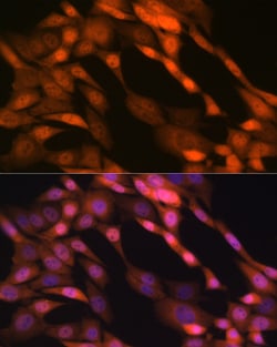 Invitrogen p23 Recombinant Rabbit Monoclonal Antibody (10M9W8) 100 &mu;L;