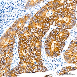 Invitrogen CDH17 Recombinant Rabbit Monoclonal Antibody (9X2S3) 100 &mu;L;
