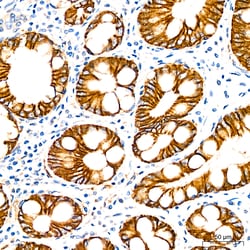 Invitrogen CDH17 Recombinant Rabbit Monoclonal Antibody (9X2S3) 100 &mu;L;