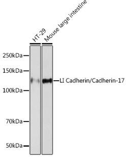 Invitrogen CDH17 Recombinant Rabbit Monoclonal Antibody (9X2S3) 100 &mu;L;