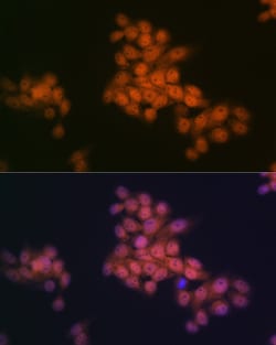 Invitrogen WAPL Recombinant Rabbit Monoclonal Antibody (3Q4G1) 100 &mu;L;