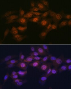 Invitrogen WAPL Recombinant Rabbit Monoclonal Antibody (3Q4G1) 100 &mu;L;