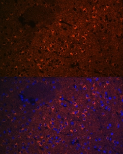 Invitrogen CEND Recombinant Rabbit Monoclonal Antibody (1D3Z1) 100 &mu;L;