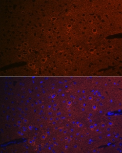Invitrogen CEND Recombinant Rabbit Monoclonal Antibody (1D3Z1) 100 &mu;L;
