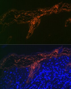 Invitrogen PERP Recombinant Rabbit Monoclonal Antibody (1O3L5) 100 &mu;L;