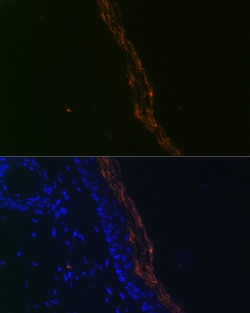 Invitrogen PERP Recombinant Rabbit Monoclonal Antibody (1O3L5) 100 &mu;L;