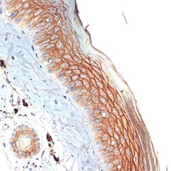 Invitrogen PERP Recombinant Rabbit Monoclonal Antibody (1O3L5) 100 &mu;L;